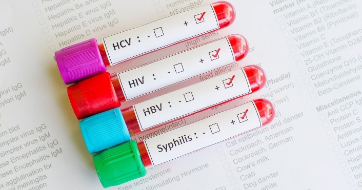 Diferencia entre ITS y ETS