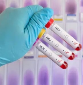STD prevention test
