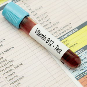 tubo de laboratorio con muestra de sangre