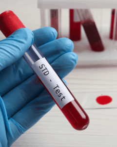 Get tested if you have Chlamydia Symptoms