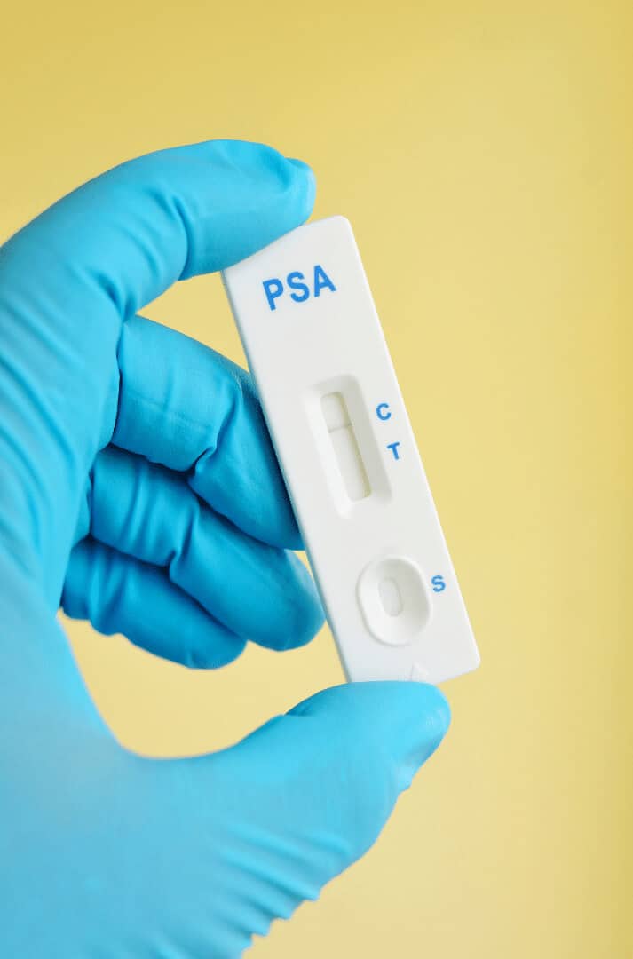 Non-prostate PSA rise