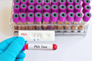 PSA tube laboratory test - analysis